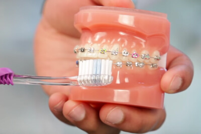 how to brush and floss with braces