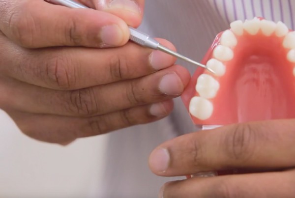 video Teeth Treatments