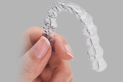 invisalign questions