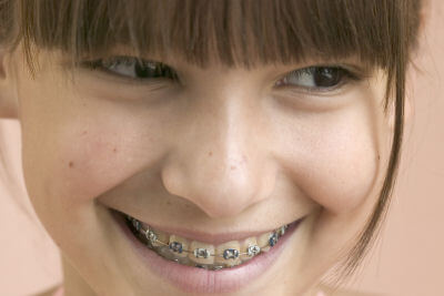 what to do about painful braces