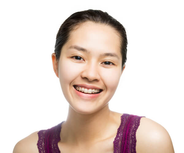 braces procedure Surrey