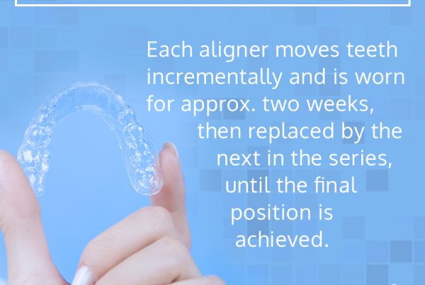 invisalign facts