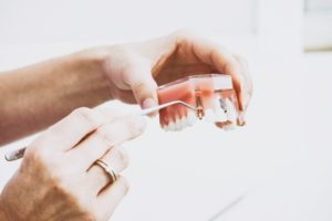 orthodontics dental implant