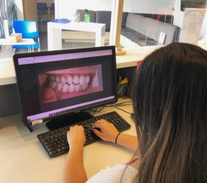 Different Orthodontic Treatments To Address Bite Problems