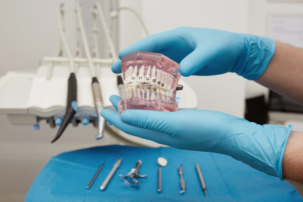 Dentist-Showing-Dental-Plastic-Model-With-Braces-Human-Teeth-Jaw