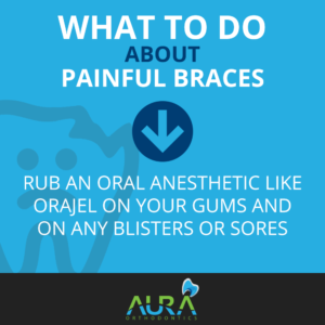 What to do about Painful Braces solution