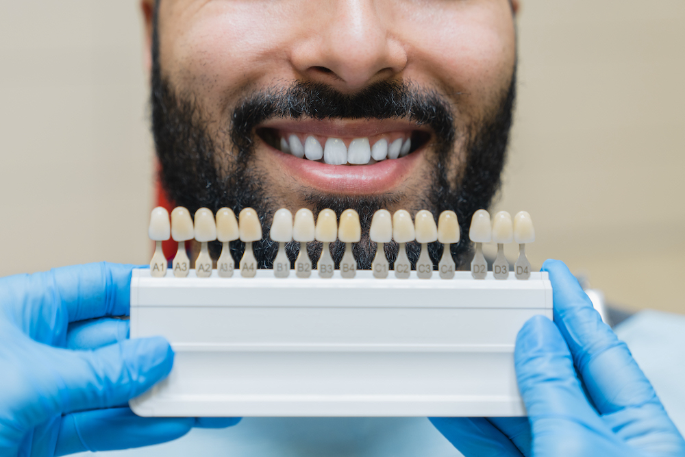 Man smiling while a tray of dental veneers are held in front of him.