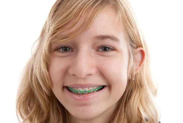Smiling teenage girl with green braces showing confidence after orthodontic treatment