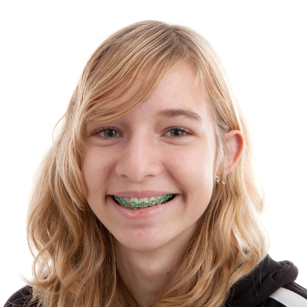 Smiling teenage girl with green braces showing confidence after orthodontic treatment